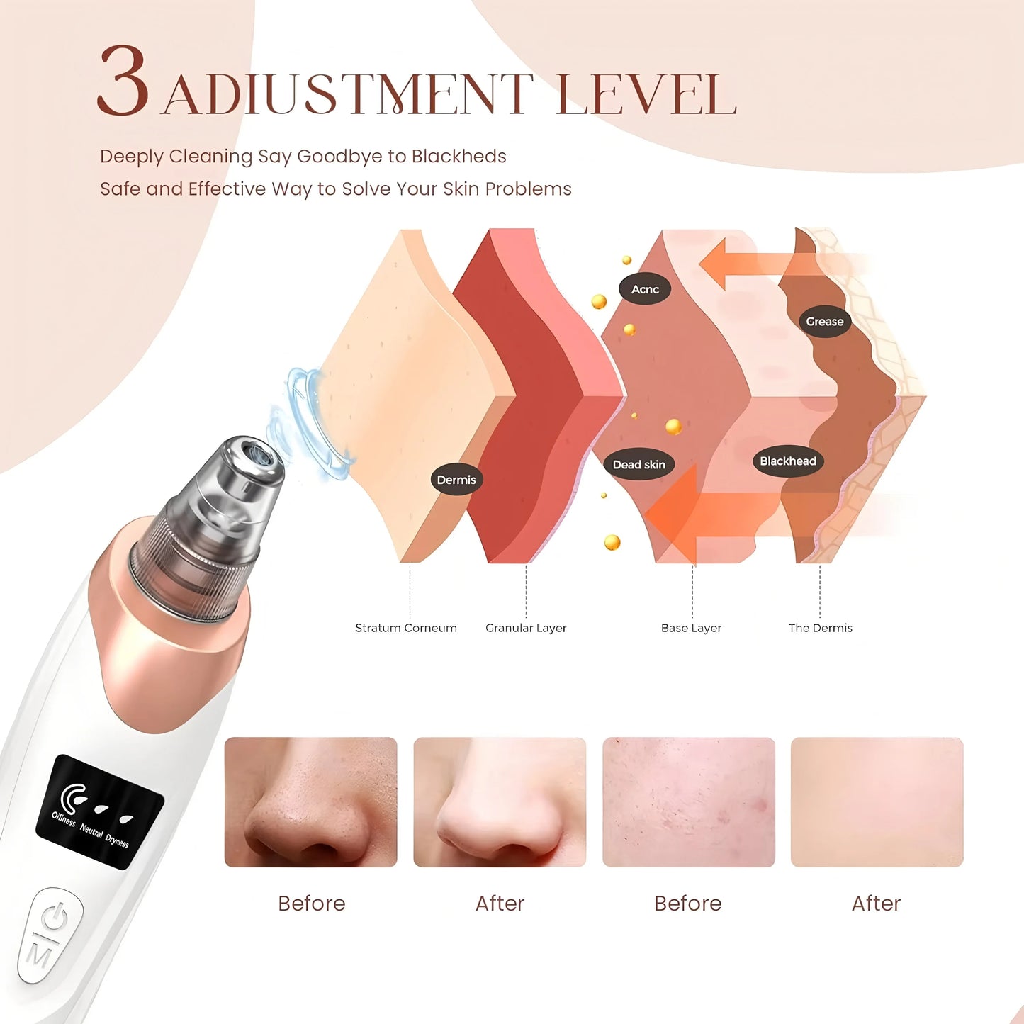 Electric Pore Cleaner & Blackhead Remover